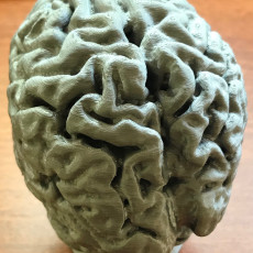 Picture of print of Human Brain