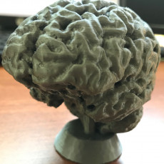 Picture of print of Human Brain