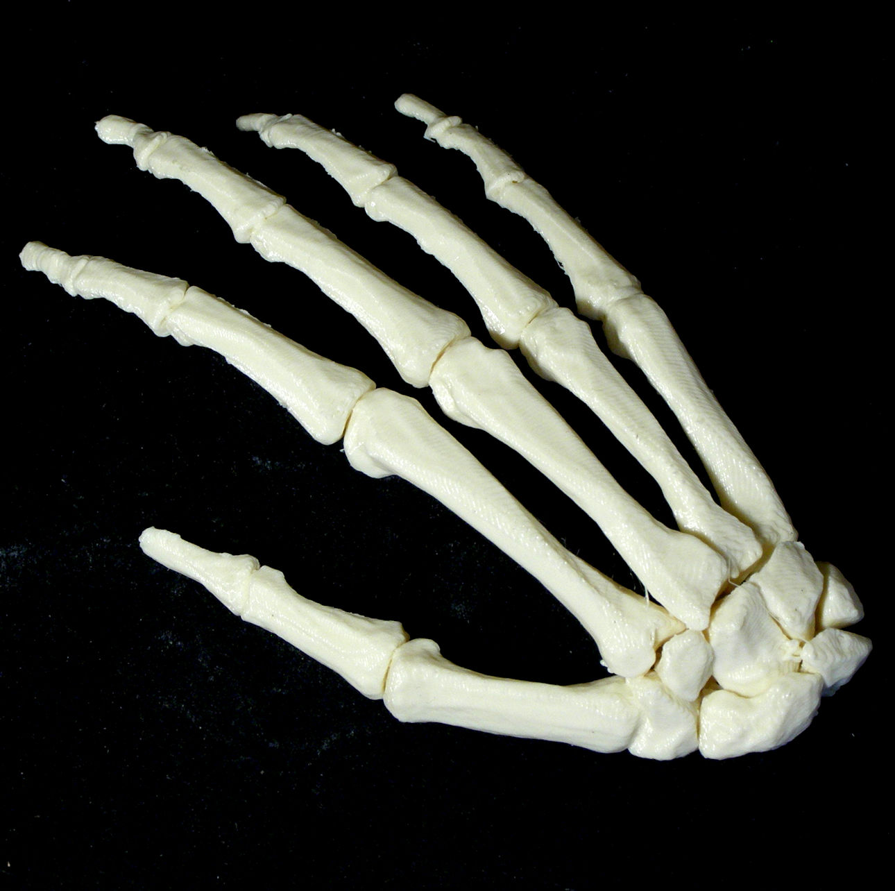Hand bone. Кости metacarpi. Кости кисти (ossa Manus) anomaliya. Skeleton hand 3d. Hand Bones.