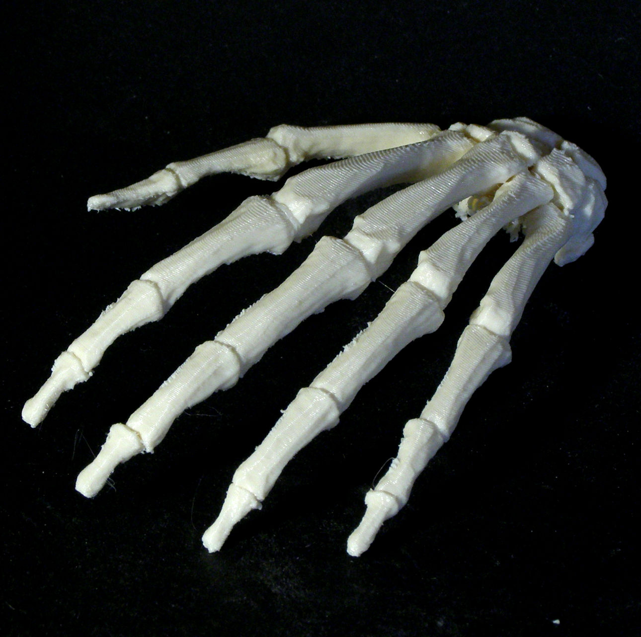 Bone - Hand - Left image