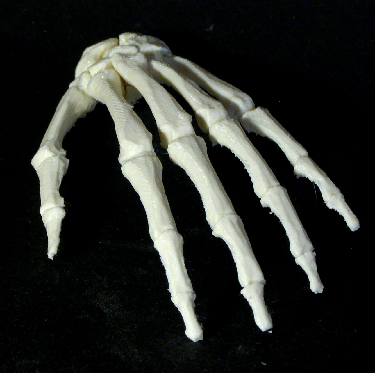Bone - Hand - Left image