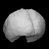 Foetus Brain image
