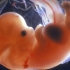 Foetal Brain image