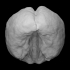 Foetal Brain (14 weeks) image