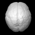 Foetal Brain (14 weeks) image