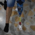 3D print prosthetic foot image