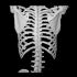 Spine with a T10 chance fracture image