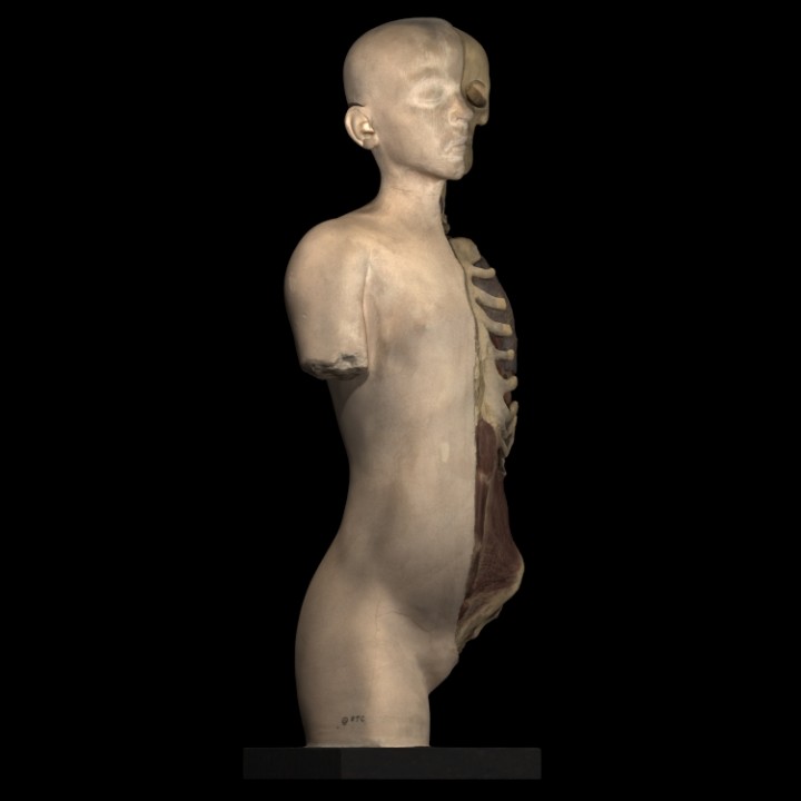 Plaster model of torso and head, showing partial dissection