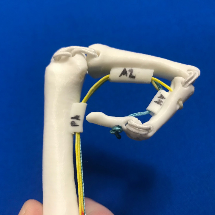 3D Printable Finger Flexor Tendon Anatomy Model (Left Index) by Robin Janson